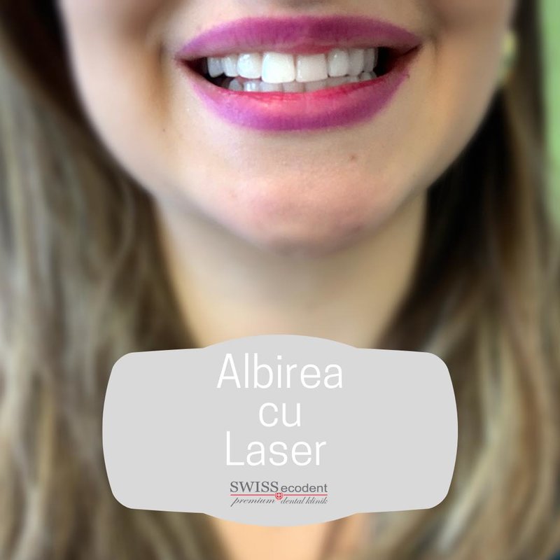 Swiss Ecodent Klinik - Clinica stomatologica Bucuresti